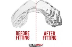 Protège-dents Simple, Thermoformable - Translucide, Safe Jawz -Martiaux Fitness Magasin protege dents simple thermoformable translucide safe jaws 3
